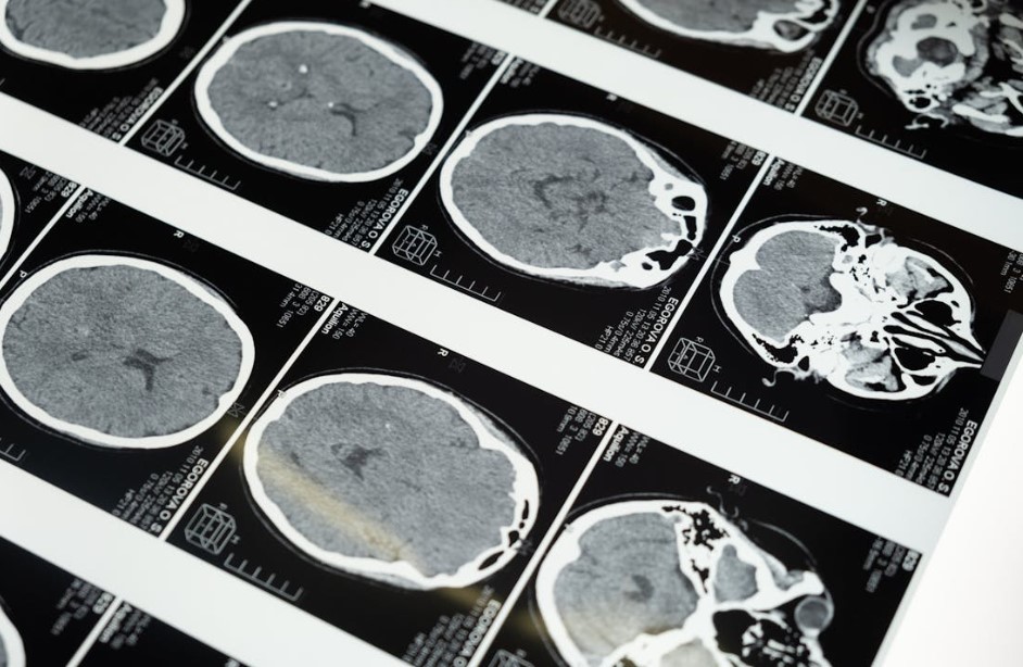 red wine and brain health